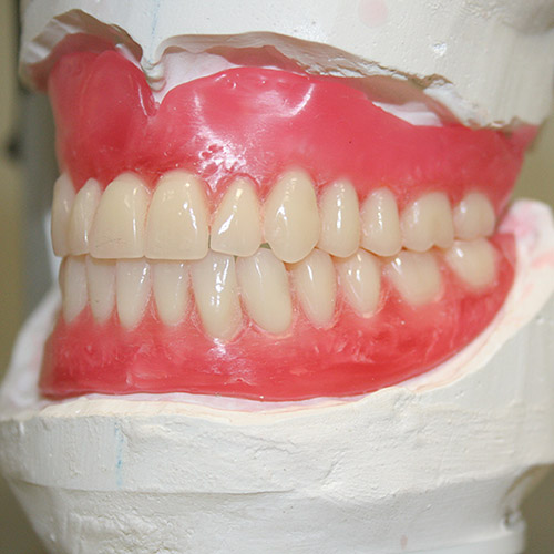 Atlas made denture